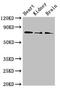 Solute Carrier Family 5 Member 1 antibody, LS-C679520, Lifespan Biosciences, Western Blot image 