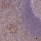 TNF Superfamily Member 12 antibody, NBP2-46811, Novus Biologicals, Immunohistochemistry paraffin image 