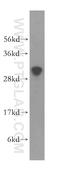 Thymocyte Nuclear Protein 1 antibody, 15867-1-AP, Proteintech Group, Western Blot image 