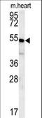 Hes Related Family BHLH Transcription Factor With YRPW Motif 2 antibody, LS-C166848, Lifespan Biosciences, Western Blot image 