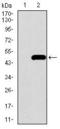 Bone Morphogenetic Protein Receptor Type 1A antibody, GTX60675, GeneTex, Western Blot image 