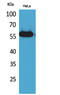 Amylase Alpha 1C (Salivary) antibody, STJ96529, St John