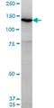 Unc-13 Homolog D antibody, H00201294-M05, Novus Biologicals, Western Blot image 