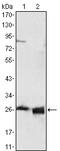 Apolipoprotein A1 antibody, STJ97832, St John