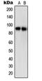 Signal Transducer And Activator Of Transcription 5A antibody, orb214623, Biorbyt, Western Blot image 