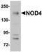 NLR Family CARD Domain Containing 5 antibody, orb94578, Biorbyt, Western Blot image 