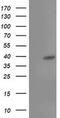 TBC1 Domain Family Member 21 antibody, MA5-25726, Invitrogen Antibodies, Western Blot image 