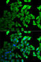 Septin 2 antibody, 19-865, ProSci, Immunofluorescence image 