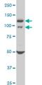 WW Domain Containing E3 Ubiquitin Protein Ligase 1 antibody, H00011059-M01, Novus Biologicals, Western Blot image 