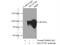 Alpha-1,6-Mannosylglycoprotein 6-Beta-N-Acetylglucosaminyltransferase B antibody, 16993-1-AP, Proteintech Group, Immunoprecipitation image 