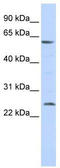 Chromaffin granule amine transporter antibody, TA339065, Origene, Western Blot image 