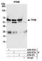 Transcription Factor EB antibody, A700-070, Bethyl Labs, Immunoprecipitation image 