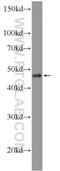 Transcription Factor AP-2 Epsilon antibody, 25829-1-AP, Proteintech Group, Western Blot image 