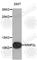 Inner Mitochondrial Membrane Peptidase Subunit 2 antibody, A5036, ABclonal Technology, Western Blot image 