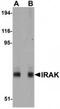 Interleukin 1 Receptor Associated Kinase 1 antibody, TA319668, Origene, Western Blot image 