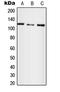 Ubiquitination Factor E4A antibody, LS-B13620, Lifespan Biosciences, Western Blot image 