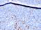 CD25 antibody, GTX18115, GeneTex, Immunohistochemistry paraffin image 