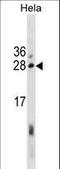 Estrogen Receptor Binding Site Associated Antigen 9 antibody, LS-C157699, Lifespan Biosciences, Western Blot image 