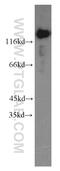 Thyroid Hormone Receptor Associated Protein 3 antibody, 19744-1-AP, Proteintech Group, Western Blot image 