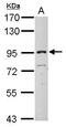 Inter-Alpha-Trypsin Inhibitor Heavy Chain 3 antibody, TA308912, Origene, Western Blot image 