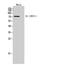 Interleukin-12 receptor subunit beta-1 antibody, STJ97309, St John