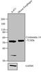 Keratin 14 antibody, MA5-11599, Invitrogen Antibodies, Western Blot image 