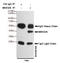 Mitogen-Activated Protein Kinase Kinase 6 antibody, M02011-2, Boster Biological Technology, Enzyme Linked Immunosorbent Assay image 