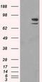 SATB Homeobox 1 antibody, MA5-24961, Invitrogen Antibodies, Western Blot image 