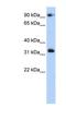 Coiled-Coil Domain Containing 69 antibody, NBP1-56589, Novus Biologicals, Western Blot image 