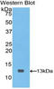 Polymeric Immunoglobulin Receptor antibody, LS-C304063, Lifespan Biosciences, Western Blot image 