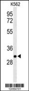 Phosphoglycolate Phosphatase antibody, 64-148, ProSci, Western Blot image 