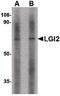 Leucine-rich repeat LGI family member 2 antibody, PA5-20493, Invitrogen Antibodies, Western Blot image 