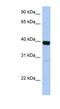 Zinc Finger Protein 385B antibody, NBP1-79420, Novus Biologicals, Western Blot image 