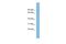 Family With Sequence Similarity 160 Member B2 antibody, A17467, Boster Biological Technology, Western Blot image 