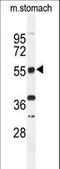 TOX High Mobility Group Box Family Member 3 antibody, LS-C160124, Lifespan Biosciences, Western Blot image 