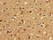 LIMK antibody, LS-C678489, Lifespan Biosciences, Immunohistochemistry paraffin image 