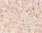 Mitochondrial Antiviral Signaling Protein antibody, PA5-20349, Invitrogen Antibodies, Immunohistochemistry paraffin image 