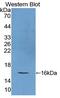 Regenerating Family Member 4 antibody, MBS2027860, MyBioSource, Western Blot image 