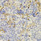 PR domain zinc finger protein 5 antibody, A06736, Boster Biological Technology, Immunohistochemistry paraffin image 