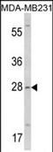 Collectin Subfamily Member 11 antibody, PA5-72477, Invitrogen Antibodies, Western Blot image 