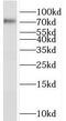 Sortilin Related VPS10 Domain Containing Receptor 1 antibody, FNab08113, FineTest, Western Blot image 