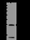 CD69 Molecule antibody, 201192-T32, Sino Biological, Western Blot image 