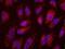 BRCA1 Associated RING Domain 1 antibody, NB100-319, Novus Biologicals, Proximity Ligation Assay image 