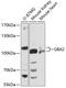 Glucosylceramidase Beta 2 antibody, 14-652, ProSci, Western Blot image 