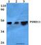 Proteasome 26S Subunit, Non-ATPase 11 antibody, A08940, Boster Biological Technology, Western Blot image 