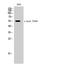 Erythropoietin Receptor antibody, A00427Y368, Boster Biological Technology, Western Blot image 