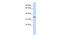 Rh Blood Group CcEe Antigens antibody, A02375, Boster Biological Technology, Western Blot image 