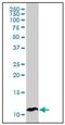 Pancreatic secretory trypsin inhibitor antibody, AM31023PU-N, Origene, Western Blot image 