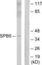 Serpin Family B Member 5 antibody, LS-C119595, Lifespan Biosciences, Western Blot image 