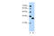 Transcription Factor EC antibody, 27-535, ProSci, Western Blot image 